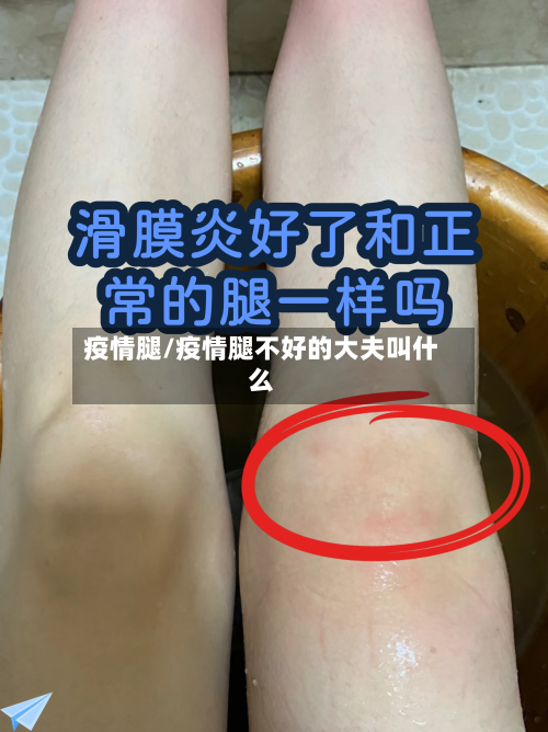 疫情腿/疫情腿不好的大夫叫什么-第2张图片