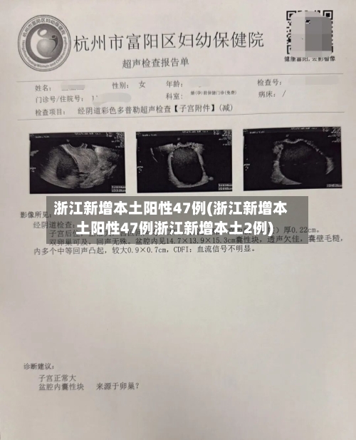 浙江新增本土阳性47例(浙江新增本土阳性47例浙江新增本土2例)-第2张图片